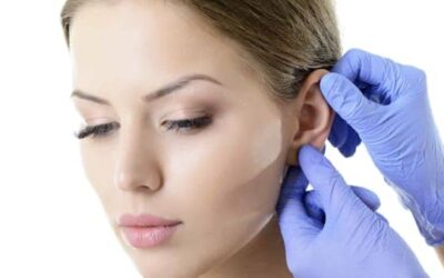 Implant Earfold : prix et tarifs