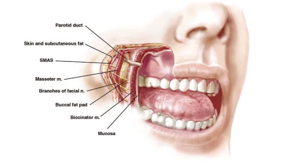 ablation boules de bichat bichectomie paris chirurgien esthetique du visage paris docteur loreto