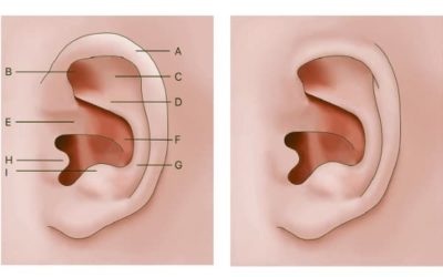 Correction non chirurgicale des anomalies de l’oreille depuis la naissance : mythe ou légende ?