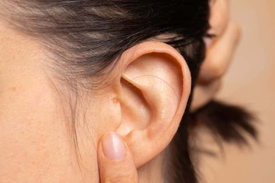 chirurgie lobe oreille fendu solution paris dr federico loreto chirurgien esthetique paris 16 chirurgie oreilles paris