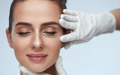 Quel est le résultat d’une blépharoplastie ?