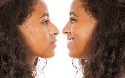 Rhinoplastie ethnique ratée : que faire ?