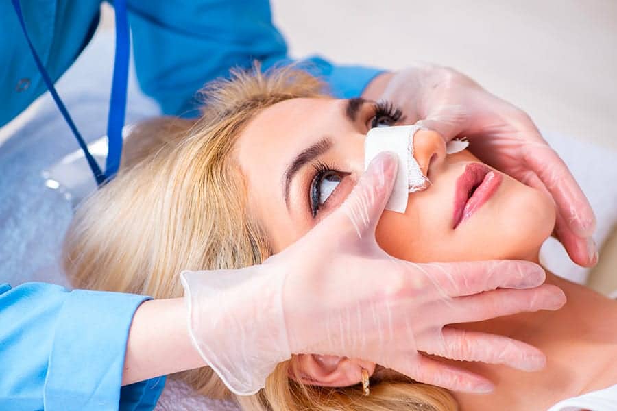 Comment est la cicatrice d’une rhinoplastie ?