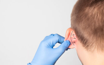 Pourquoi a-t-on une oreille en chou-fleur et quel est son traitement ?
