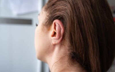 Oreille en chou-fleur : quel traitement ?