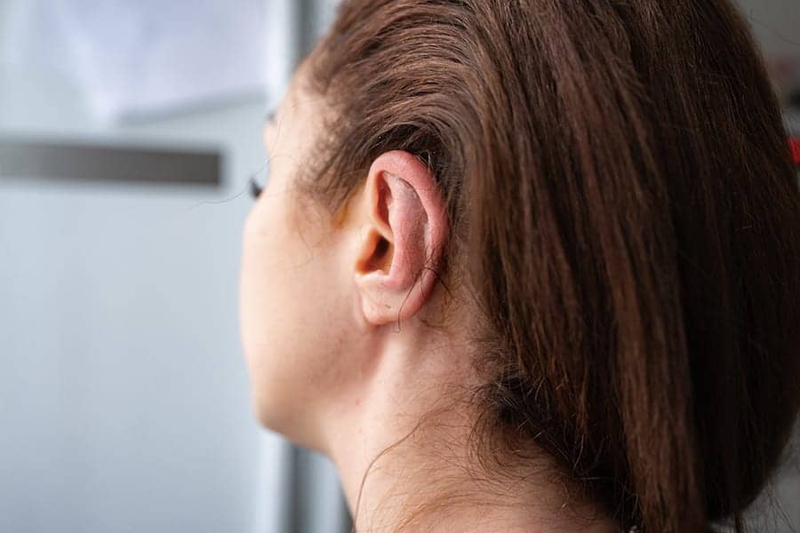 Oreille en chou-fleur : quel traitement ?